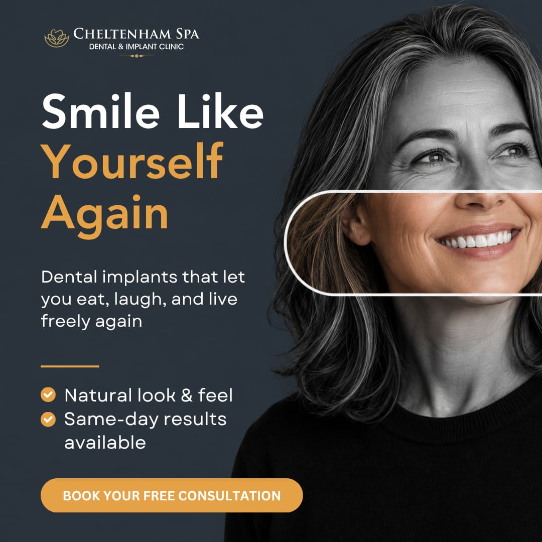 Invisalign V2