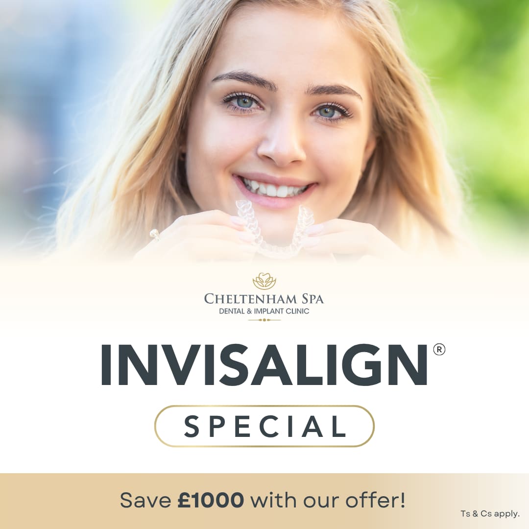 Invisalign Special