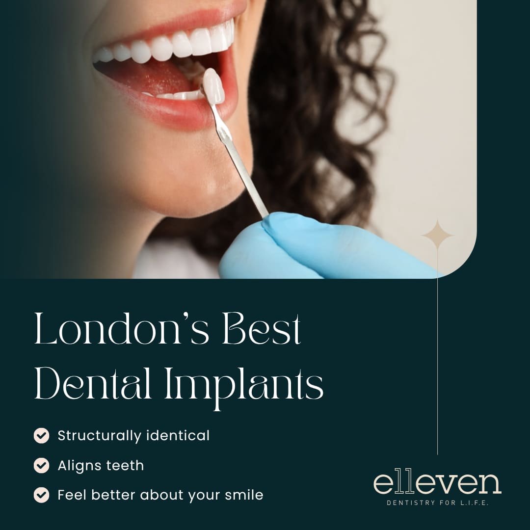 London Implants
